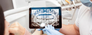 Zahnarzt digitales röntgen