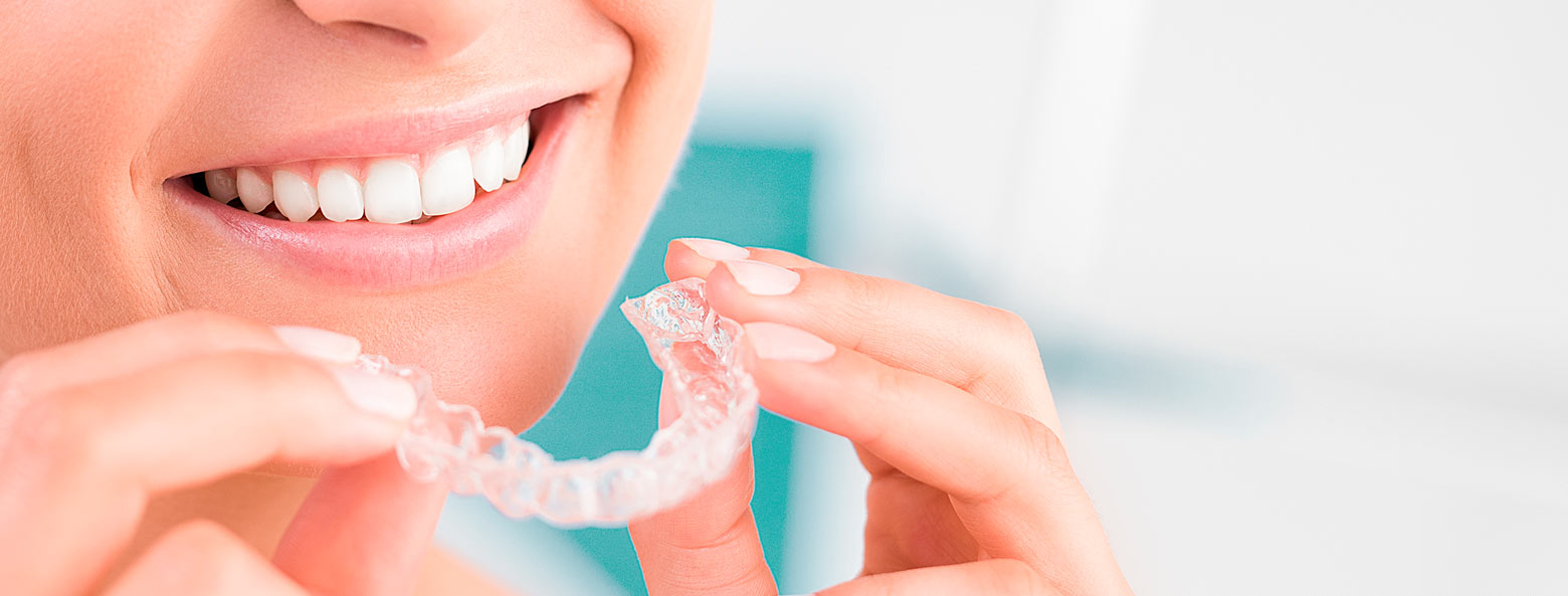 Invisalign Grenzach, Lörrach, Rheinfelden